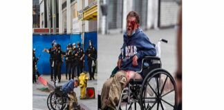 Homeless Man Shot within the Face With bullet by LAPD